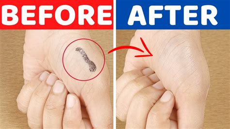 Easiest Way To Remove Permanent Marker Sharpie From Skin With