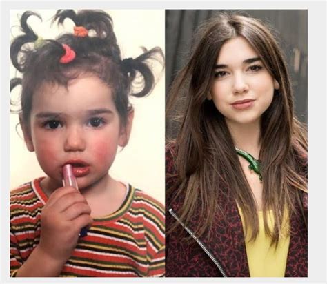 Fotos de Dua Lipa antes y después de sus cirugías se viralizan