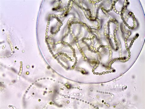 Check spelling or type a new query. Nostoc Under Microscope 40x - Micropedia