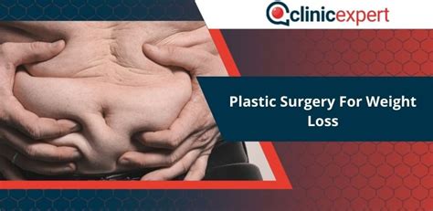 Plastic Surgery For Weight Loss Clinicexpert