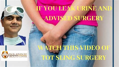 Stress Urinary Incontinence Mesh Sling For Stress Urinary Incontinence Surgery Youtube
