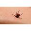 Study Refutes Lasting Treatment For Lyme Disease