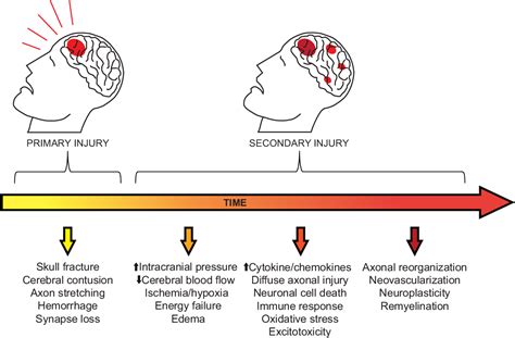 Pdf Chronic Pain After Traumatic Brain Injury Pathophysiology And