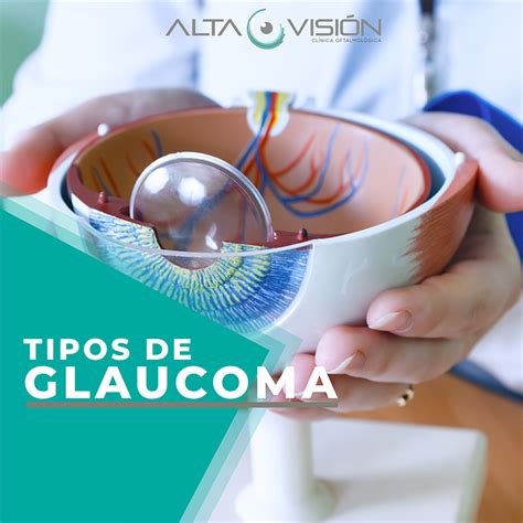 Tipos De Glaucoma Cl Nica Alta Visi N Panam