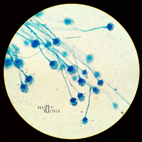 Aspergillus Fumigatus Culture Plate 1 2 Aspergillus Flavus 3 4