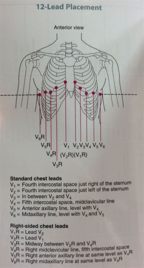 Our Ems Site 12 Lead Diagram For Both Left And Right Side