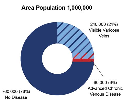 Vancouver Wa Vein Clinic Inovia Vein Specialty Centers