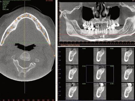 Ct Scans In Dentistry Cascades Center For Dental Health