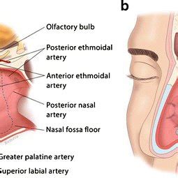 Applying a protective, moisturizing ointment such as petroleum jelly can help reduce symptoms while the. Endoscopic view of nasal septum perforation demonstrates ...