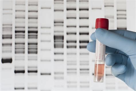 The Best DNA Testing kits To Learn About Health, Ancestry