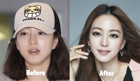Chinese Actress Plastic Surgery Before And After