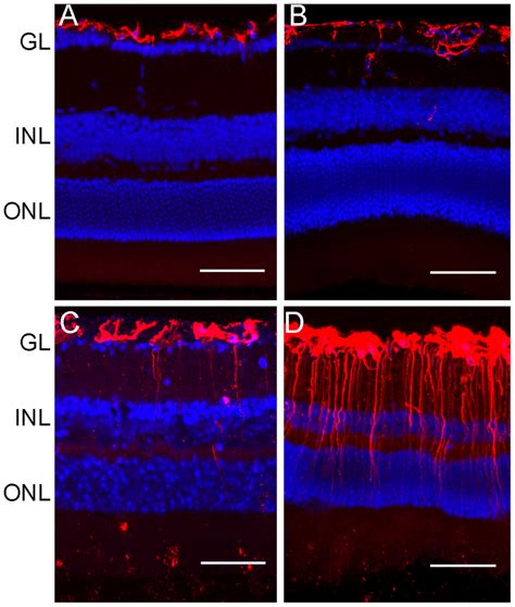 Retinal Gfap Expression In Wt And Ccl2 2 2 Cx3cr1 Gfpgfp Mice