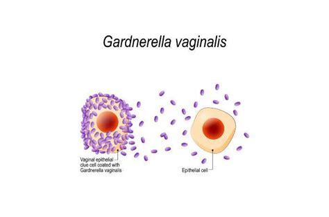 Infezione Da Gardnerella Vaginalis Sintomi E Trattamento My Xxx Hot Girl