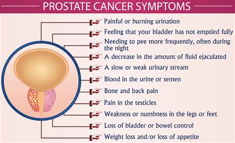 Prostate Cancer Symptoms Infographic Vector Illustration Health