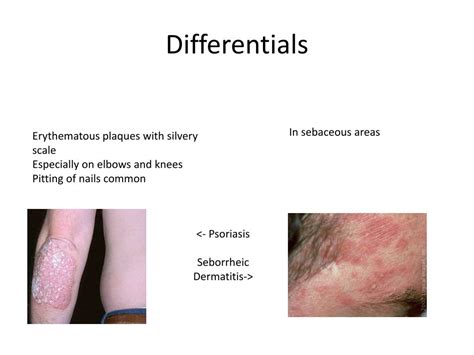 Ppt Slackers Guide To Skin Lesions Powerpoint Presentation Free