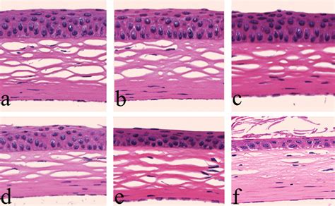 Corneal Damage Induced In Adult Mice By A Single Intraperitoneal