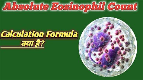 Absolute Eosinophil Count Formula How To Manual Count Eosinophil
