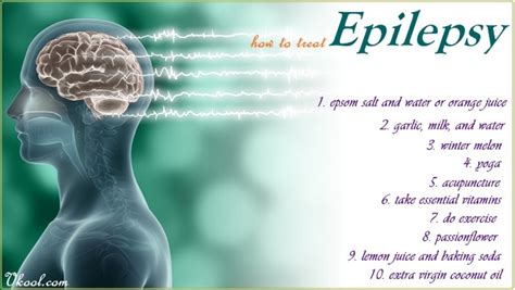 10 Tips On How To Treat Epilepsy Naturally