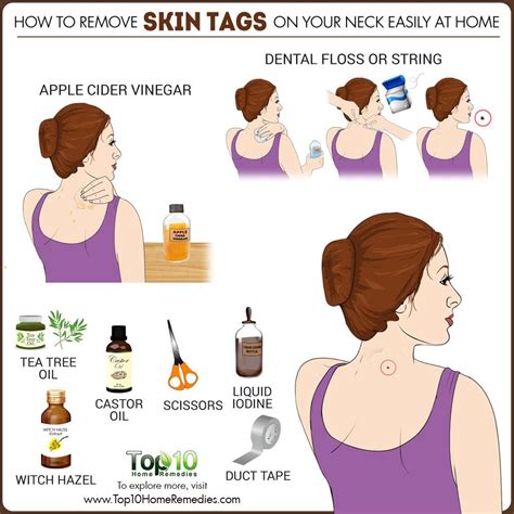 how to remove skin tags on your neck easily at home top 10 home remedies