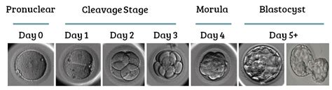 Complete Guide To Embryo Grading And Success Rates Remembryo