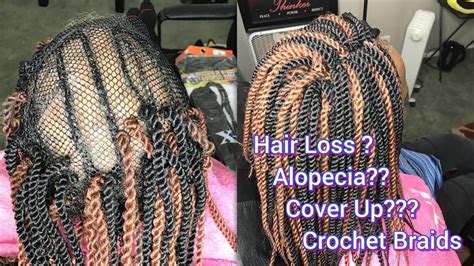 How To Cover Bald Spots With Dreads Ella Scholten Coiffure