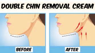 How To Get Rid Of Double Chin Double Chin Removal Cream Remove
