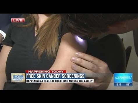 Free Skin Cancer Screenings For Melanoma Monday Youtube