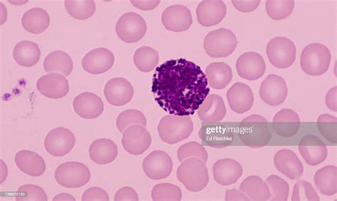 Basophil White Blood Cell Shows Large Basophilic Granules In The