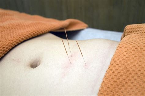Acupuncture For Painful Conditions Ido Holistic Center