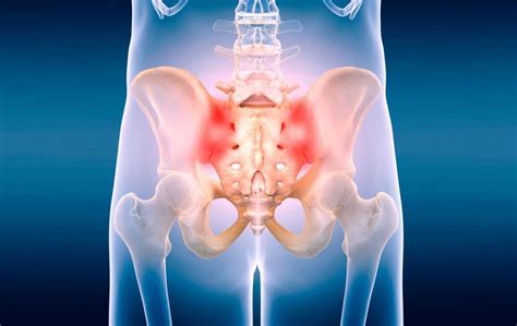 Dysfunction In The Sacroiliac Joint Timothy Spencer Do Minimally