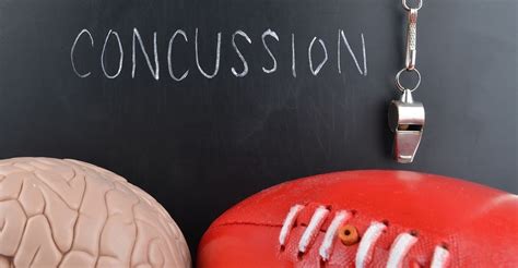 In some cases, patients and observers aren't aware that a concussion has happened until they are examined by a doctor. Medic First Aid Ltd :: Emergency Care for concussion