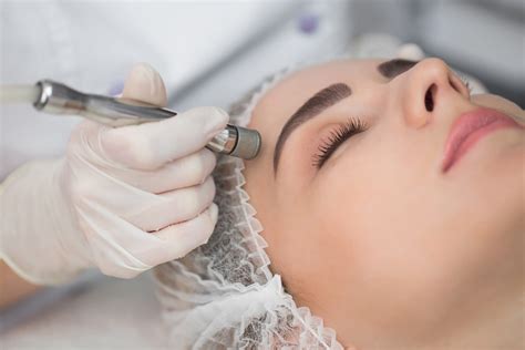 What Are Some Benefits Of Microdermabrasion