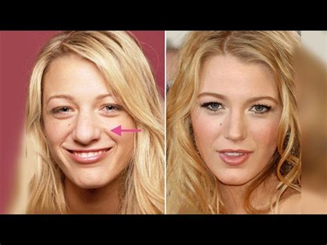Blake Lively Before Nose Job ~ Nose Surgery Celebrity Plastic Aniston Jennifer Jobs Job