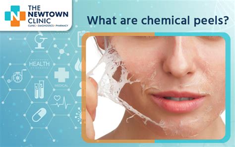 What Is Known As Chemical Peel The Newtown Clinic