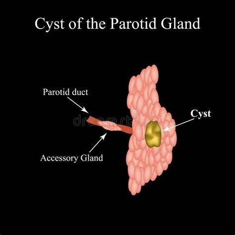 Parotid Salivary Gland The Structure Of The Parotid Salivary Gland