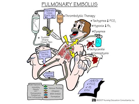 Diagnosis: Pulmonary Embolism Nursing Diagnosis