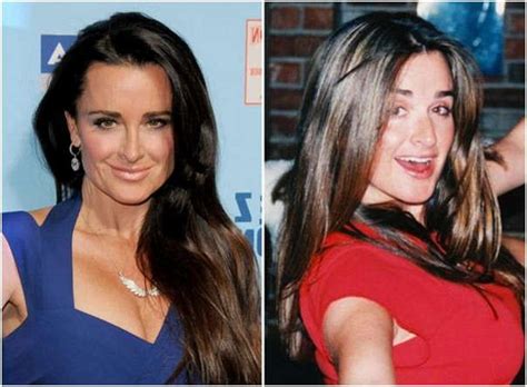 She said she was repeatedly asked to go through the body screener by an apologetic tsa agent who pointed out an anomaly over her genitals. The 25+ best Kyle richards plastic surgery ideas on ...