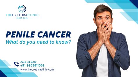 Penile Cancer Symptoms Archives The Urethra Clinic
