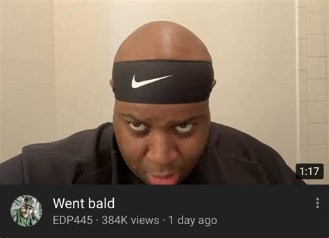 Ksi Be Getting More Support For Going Bald Then Caitlyn Jenner For