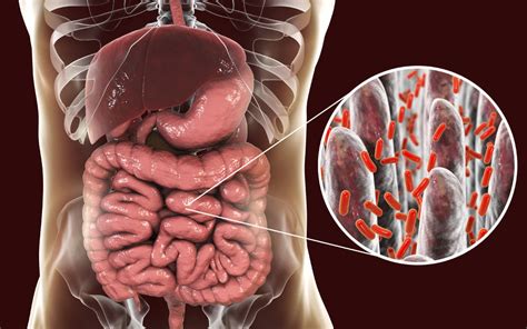 El microbioma intestinal causa enfermedades autoinmunes El médico interactivo