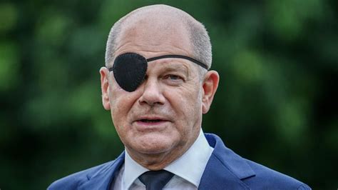 Olaf Scholz Legt Augenklappe Wieder Ab So Sieht Sein Auge Aus DKO