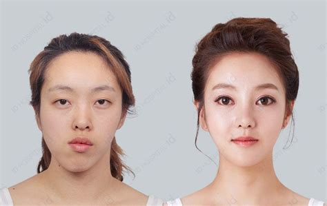 No1 Korean Plastic Surgery Id Hospital Asia Beauty Center
