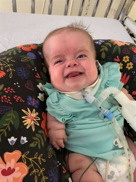 Baby With Rare Dwarfism Is Home After 184 Days In Hospital Good