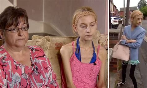 Anorexic Stockport Teen Whose Organs Are Failing Is Checked Into Clinic As Last Hope Daily
