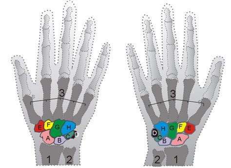 Metacarpus - wikidoc