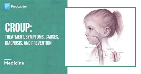 Croup Treatment Symptoms Causes Diagnosis And Prevention