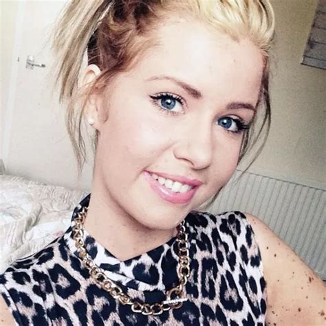 Dalmatian Girl Hits Back At Bullies Who Teased Her Over Birthmarks As She Finally Finds