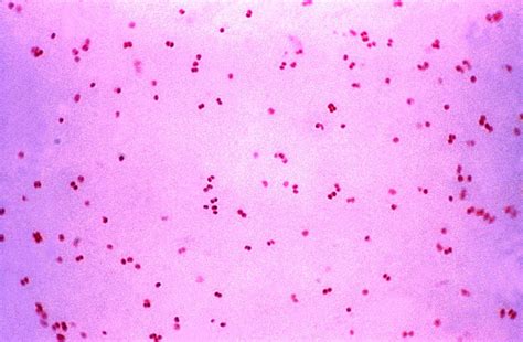 Free Picture Photomicrograph Gram Negative Bacteria Neisseria