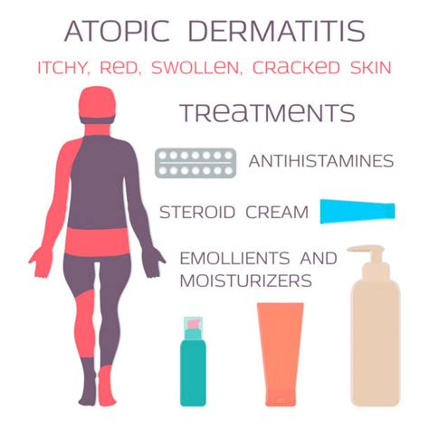 Atopic Dermatitis Kids Illustrations Royalty Free Vector Graphics