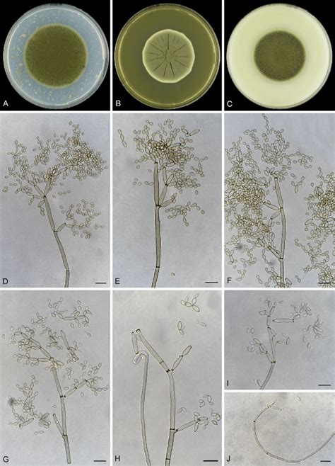 Cladosporium Velox Dto 317 H1 A C Colonies On Pda Mea And Oa D H